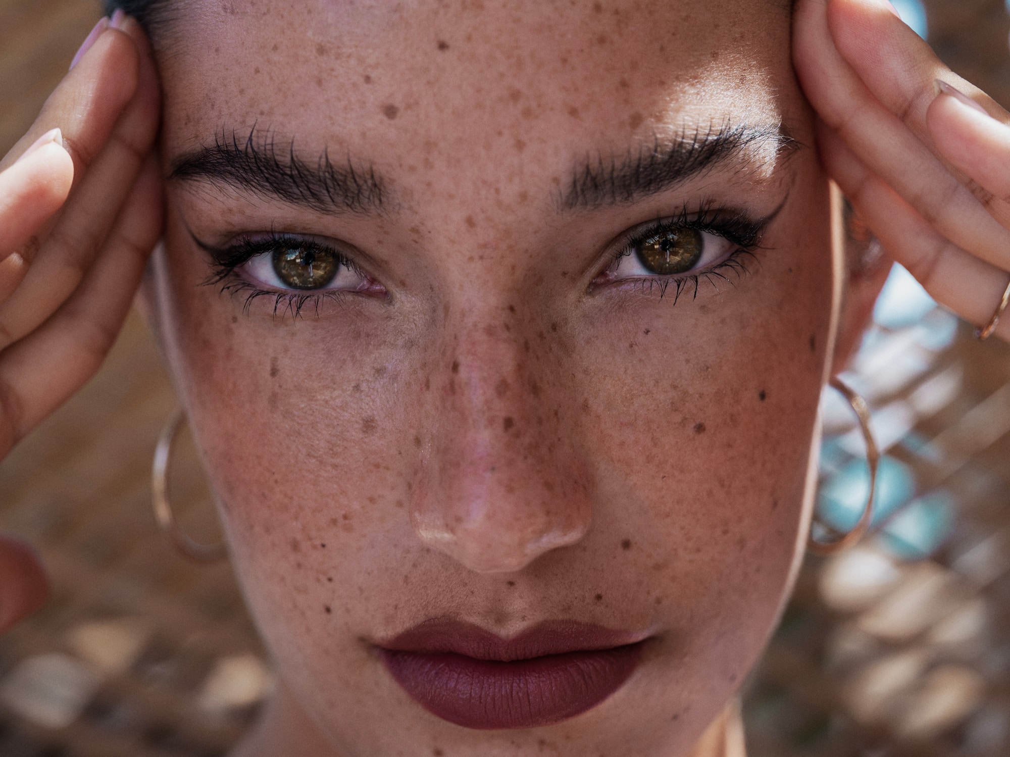 a woman with freckles holding her head
