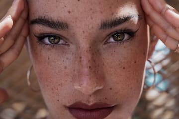 a woman with freckles holding her head